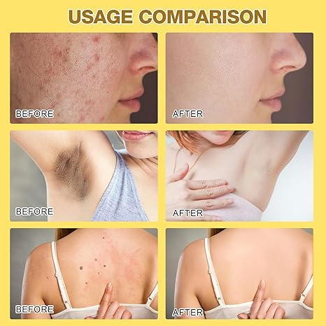 Bee Venom Skin Treatment Cream